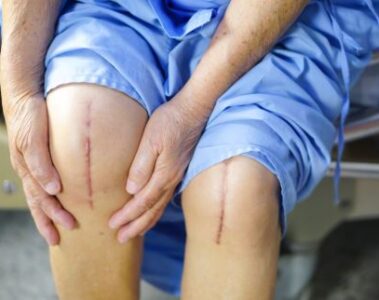 Dr. Jason Pirozzolo shares top tips for avoiding surgery recovery mistakes