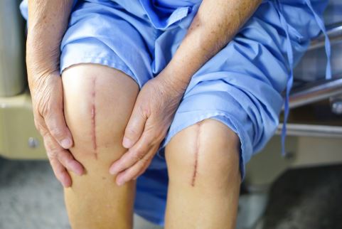 Dr. Jason Pirozzolo shares top tips for avoiding surgery recovery mistakes