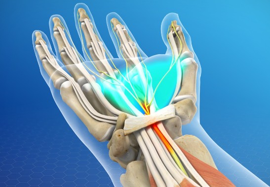 Carpal Tunnel Syndrome Relief with Dr. Jason Pirozzolo: Tips and Techniques