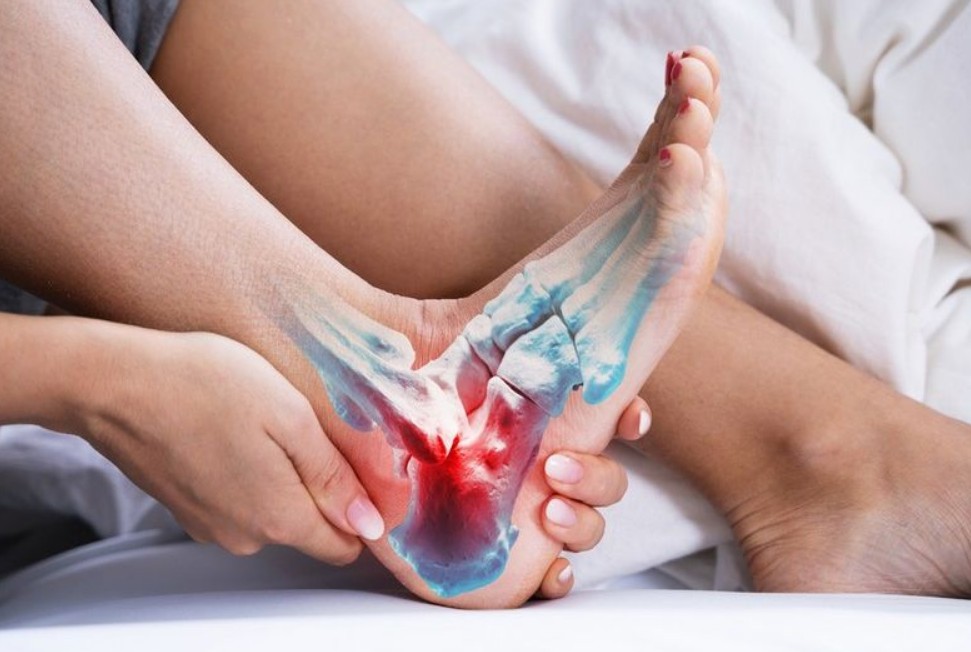 Plantar Fasciitis Relief with Dr. Jason Pirozzolo: Stretches and Supportive Solutions